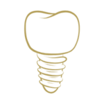 Implante dental